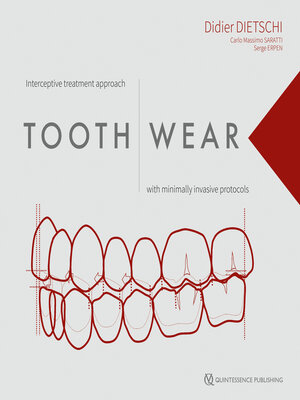 cover image of Tooth Wear